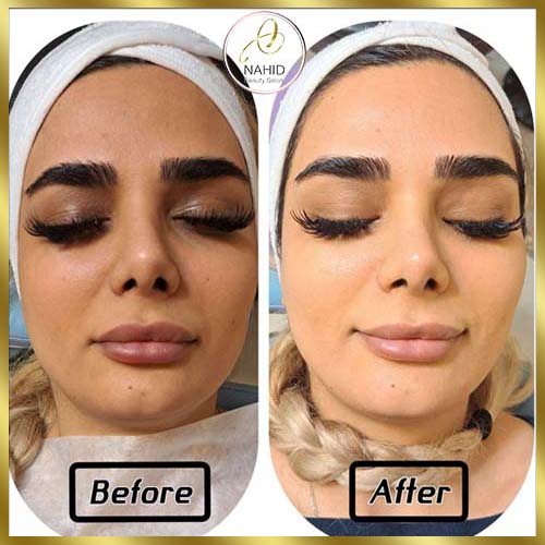 گالری پاکسازی پوست